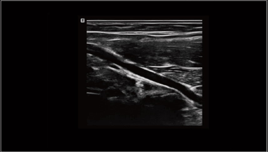 Clinical gallery image