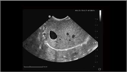 Clinical gallery image