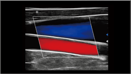 Clinical gallery image