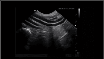 Clinical gallery image