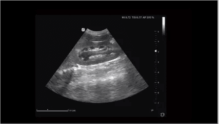 Clinical gallery image