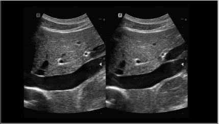 Clinical gallery image