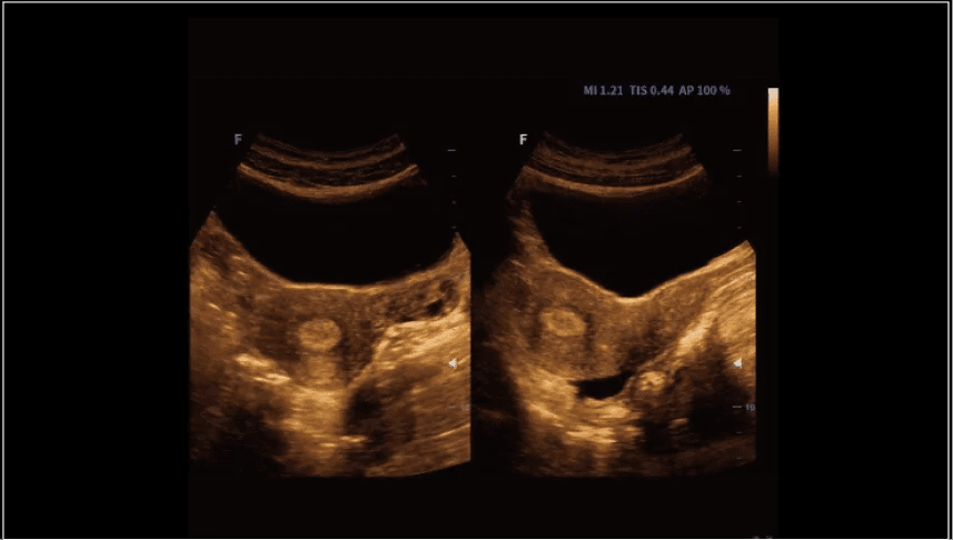 Clinical gallery image