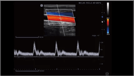 Clinical gallery image