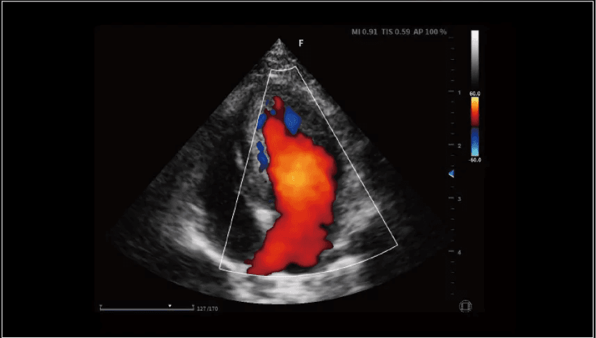 Clinical gallery image
