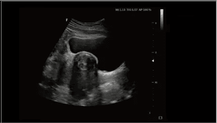 Clinical gallery image