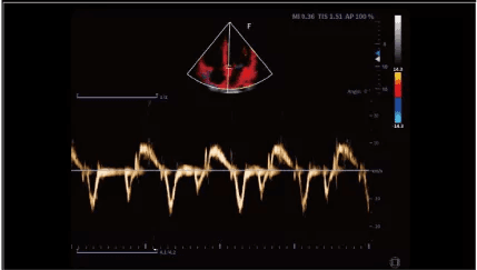 Clinical gallery image