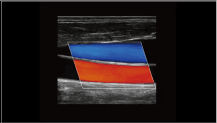 Clinical gallery image