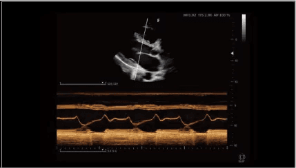 Clinical gallery image