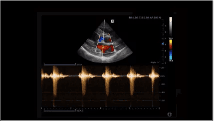 Clinical gallery image