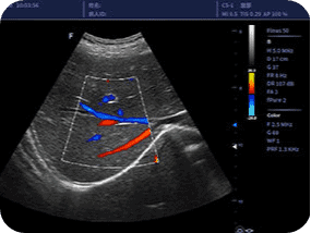 Clinical gallery image