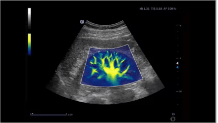 Clinical gallery image