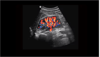 Clinical gallery image