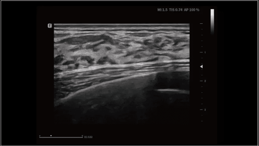 Clinical gallery image