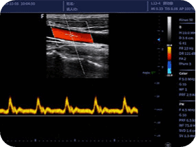 Clinical gallery image