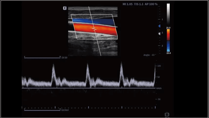 Clinical gallery image
