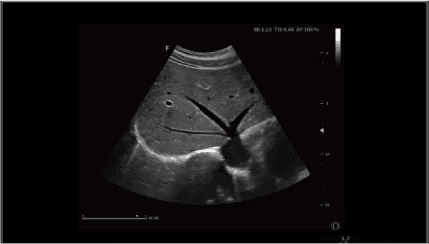 Clinical gallery image