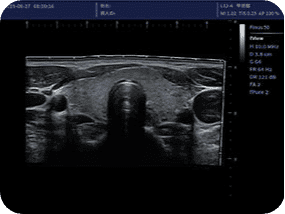 Clinical gallery image