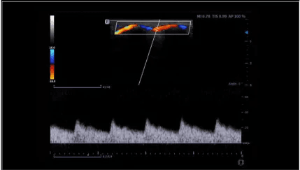 Clinical gallery image