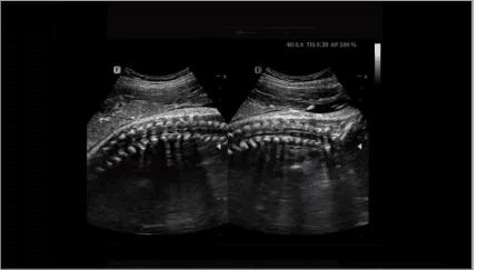 Clinical gallery image