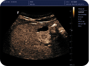 Clinical gallery image