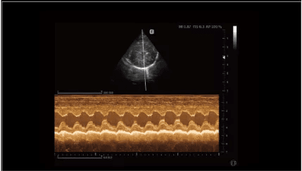 Clinical gallery image