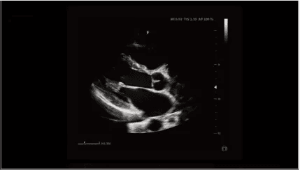 Clinical gallery image