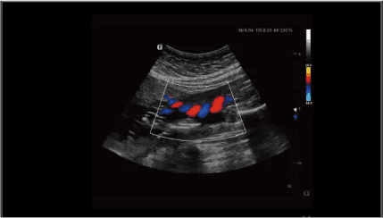 Clinical gallery image