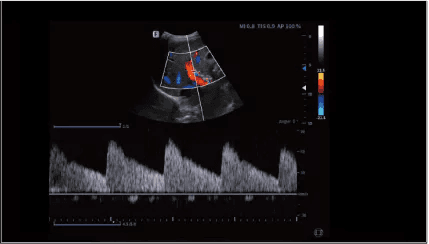 Clinical gallery image