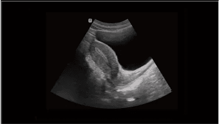 Clinical gallery image